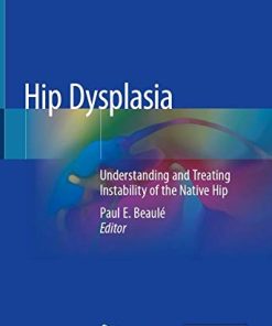 Hip Dysplasia: Understanding and Treating Instability of the Native Hip (PDF)