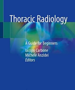 Thoracic Radiology: A Guide for Beginners (PDF)