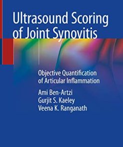 Ultrasound Scoring of Joint Synovitis: Objective Quantification of Articular Inflammation (PDF)