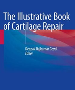 The Illustrative Book of Cartilage Repair (PDF)