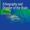 Echography and Doppler of the Brain (PDF) Echography and Doppler of the Brain (PDF)