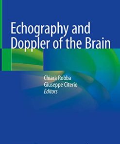 Echography and Doppler of the Brain (PDF)