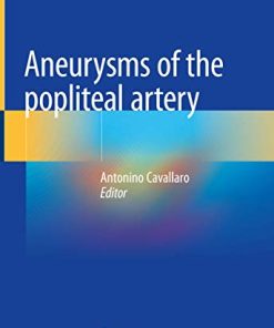 Aneurysms of the Popliteal Artery (PDF)