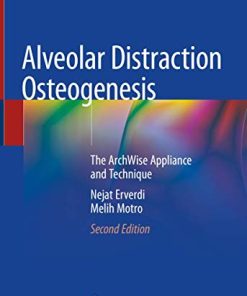 Alveolar Distraction Osteogenesis: The ArchWise Appliance and Technique, 2nd Edition (PDF)