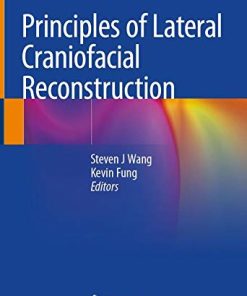 Principles of Lateral Craniofacial Reconstruction (PDF)