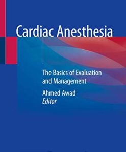 Cardiac Anesthesia: The Basics of Evaluation and Management (PDF)