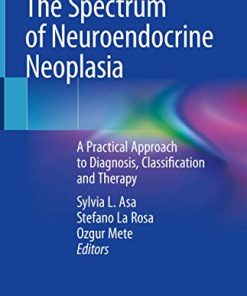 The Spectrum of Neuroendocrine Neoplasia: A Practical Approach to Diagnosis, Classification and Therapy (PDF)