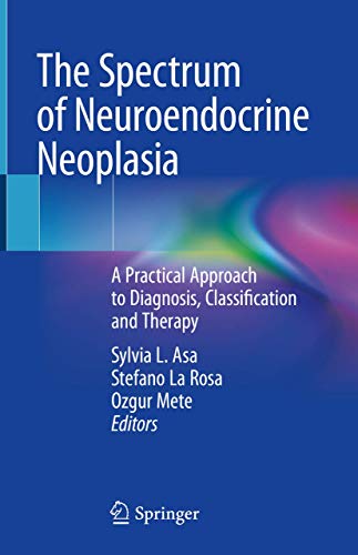 The Spectrum of Neuroendocrine Neoplasia: A Practical Approach to Diagnosis, Classification and Therapy (PDF) The Spectrum of Neuroendocrine Neoplasia: A Practical Approach to Diagnosis, Classification and Therapy (PDF)