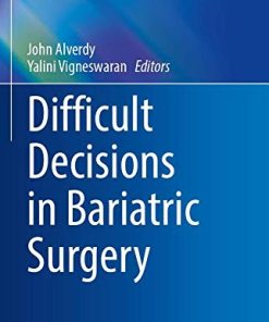 Difficult Decisions in Bariatric Surgery (Difficult Decisions in Surgery: An Evidence-Based Approach) (PDF)