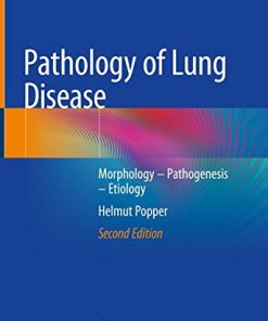 Pathology of Lung Disease: Morphology – Pathogenesis – Etiology, 2nd Edition (PDF)