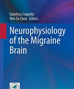 Neurophysiology of the Migraine Brain (Headache) (PDF)