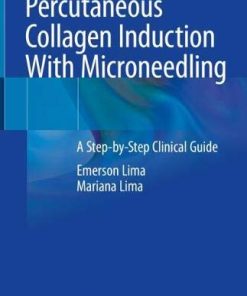 Percutaneous Collagen Induction With Microneedling: A Step-by-Step Clinical Guide (PDF)