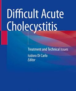 Difficult Acute Cholecystitis: Treatment and Technical Issues (PDF)