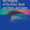 Diffusion-Weighted MR Imaging of the Brain, Head and Neck, and Spine (PDF)