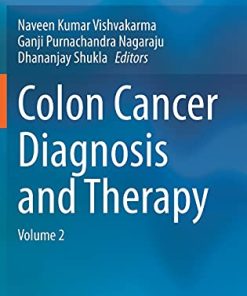 Colon Cancer Diagnosis and Therapy: Volume 2 (PDF)