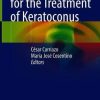 New Frontiers for the Treatment of Keratoconus (PDF)