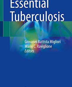 Essential Tuberculosis (PDF)