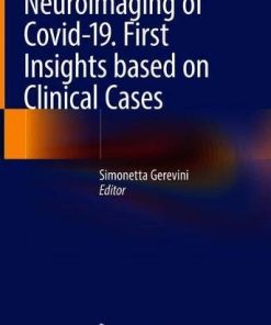 Neuroimaging of Covid-19. First Insights based on Clinical Cases (PDF)