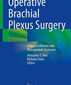 Operative Brachial Plexus Surgery: Clinical Evaluation and Management Strategies (PDF)