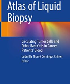 Atlas of Liquid Biopsy: Circulating Tumor Cells and Other Rare Cells in Cancer Patients’ Blood (PDF)