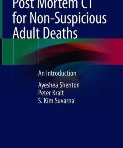 Post Mortem CT for Non-Suspicious Adult Deaths: An Introduction (PDF)