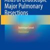 Atlas of Endoscopic Major Pulmonary Resections (3rd ed.) (PDF)