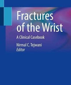 Fractures of the Wrist: A Clinical Casebook (PDF)