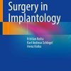 Guided Surgery in Implantology (PDF)