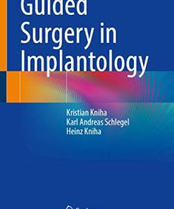 Guided Surgery in Implantology (PDF)