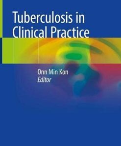 Tuberculosis in Clinical Practice (PDF)