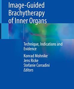 Manual on Image-Guided Brachytherapy of Inner Organs: Technique, Indications and Evidence (PDF)