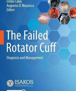 The Failed Rotator Cuff: Diagnosis and Management (PDF)