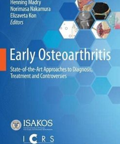 Early Osteoarthritis: State-of-the-Art Approaches to Diagnosis, Treatment and Controversies (PDF)