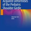 Congenital and Acquired Deformities of the Pediatric Shoulder Girdle (PDF)