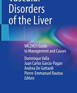 Vascular Disorders of the Liver: VALDIG’s Guide to Management and Causes (PDF)