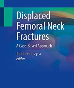 Displaced Femoral Neck Fractures: A Case-Based Approach (PDF)