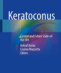 Keratoconus: Current and Future State-of-the-Art (PDF)