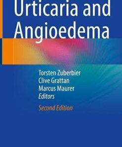 Urticaria and Angioedema, 2nd Edition (PDF)