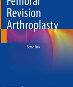 Femoral Revision Arthroplasty (PDF)