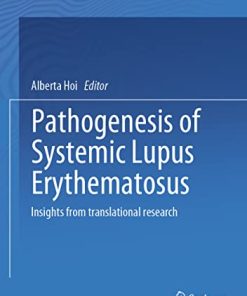 Pathogenesis of Systemic Lupus Erythematosus: Insights from Translational Research (PDF)