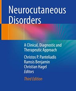 Neurocutaneous Disorders: A Clinical, Diagnostic and Therapeutic Approach (PDF)