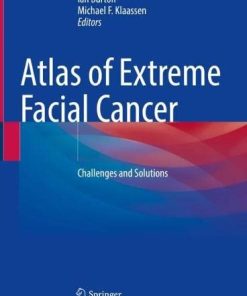 Atlas of Extreme Facial Cancer: Challenges and Solutions (PDF)