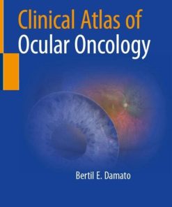 Clinical Atlas of Ocular Oncology (PDF)