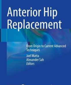 Anterior Hip Replacement: From Origin to Current Advanced Techniques (PDF)