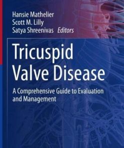 Tricuspid Valve Disease: A Comprehensive Guide to Evaluation and Management (Contemporary Cardiology) (PDF)