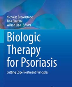 Biologic Therapy for Psoriasis: Cutting Edge Treatment Principles (Updates in Clinical Dermatology) (PDF)