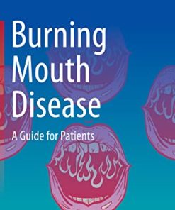 Burning Mouth Disease: A Guide for Patients (PDF)