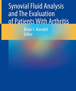 Synovial Fluid Analysis and The Evaluation of Patients With Arthritis (PDF)