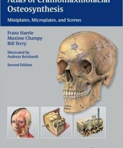 Atlas of Craniomaxillofacial Osteosynthesis: Microplates, Miniplates, and Screws, 2nd Edition