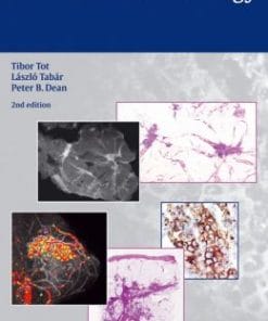 Practical Breast Pathology, 2nd Edition (PDF)